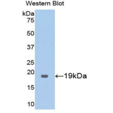 Thrombomodulin (TM) Human Polyclonal Antibody