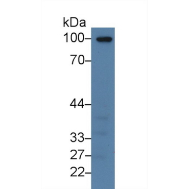 Thrombomodulin (TM) Human Polyclonal Antibody