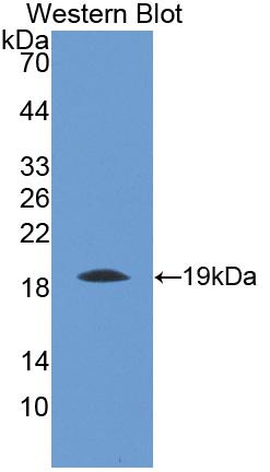 Thrombomodulin (TM) Rat Polyclonal Antibody