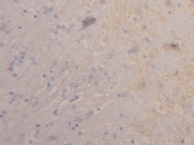 Thrombomodulin (TM) Rat Polyclonal Antibody
