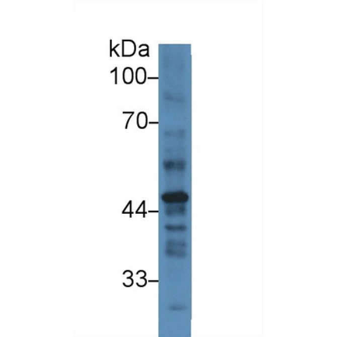 Plasminogen Activator Inhibitor 2 (PAI2) Human Polyclonal Antibody