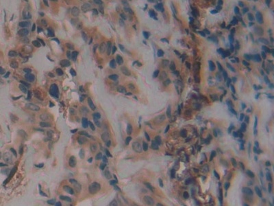 Plasminogen Activator Inhibitor 1 (PAI1) Human Polyclonal Antibody
