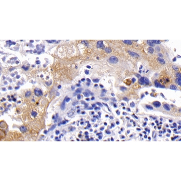 Plasminogen Activator Inhibitor 1 (PAI1) Human Polyclonal Antibody
