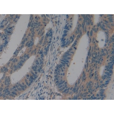 Leucine Aminopeptidase (LAP) Human Polyclonal Antibody