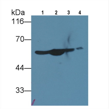 Enolase, Neuron Specific (NSE) Human Polyclonal Antibody