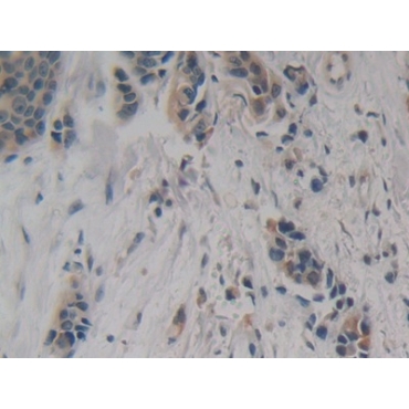 Enolase, Neuron Specific (NSE) Human Polyclonal Antibody