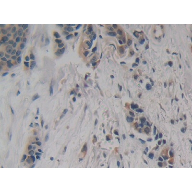 Enolase, Neuron Specific (NSE) Human Polyclonal Antibody