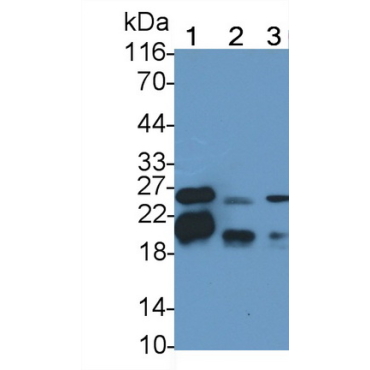 Myelin Basic Protein (MBP) Human Polyclonal Antibody