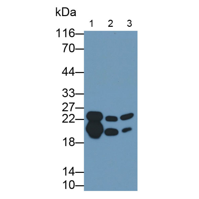 Myelin Basic Protein (MBP) Human Polyclonal Antibody