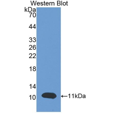 Brain Natriuretic Peptide (BNP) Human Polyclonal Antibody