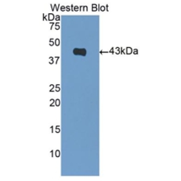 Brain Natriuretic Peptide (BNP) Mouse Polyclonal Antibody