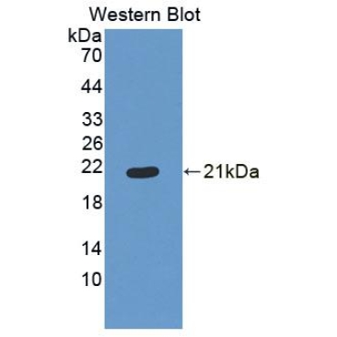 Endostatin (ES) Human Polyclonal Antibody