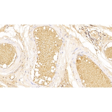 Immunoglobulin A (IgA) Human Polyclonal Antibody