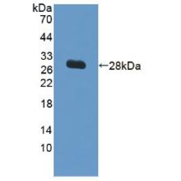 Vascular Cell Adhesion Molecule 1 (VCAM1) Human Polyclonal Antibody