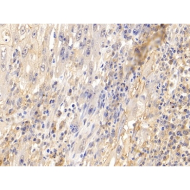 Intercellular Adhesion Molecule 1 (ICAM1) Human Polyclonal Antibody