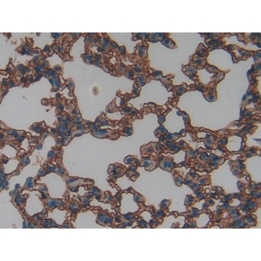Intercellular Adhesion Molecule 1 (ICAM1) Mouse Polyclonal Antibody