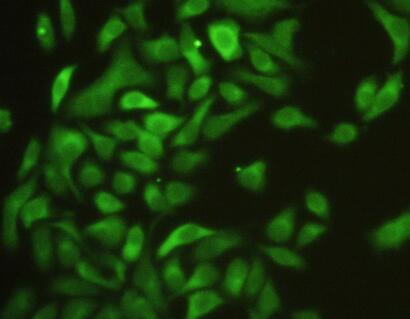 Intercellular Adhesion Molecule 1 (ICAM1) Rat Polyclonal Antibody
