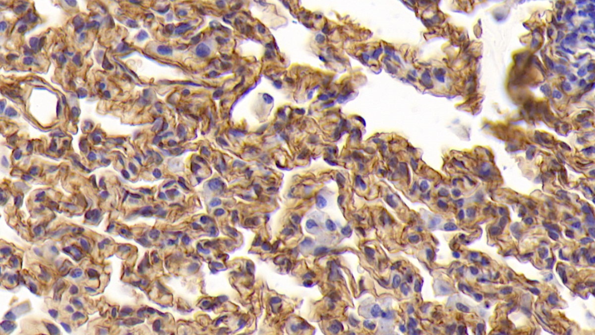 Intercellular Adhesion Molecule 1 (ICAM1) Rabbit Polyclonal Antibody