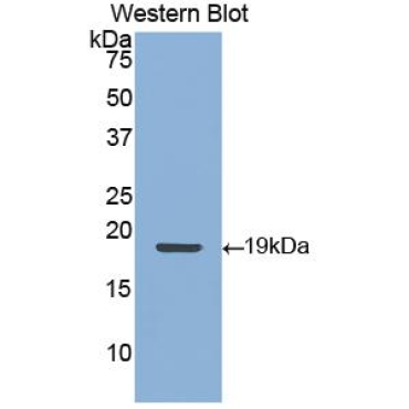 Cytokeratin 9 (CK9) Human Polyclonal Antibody