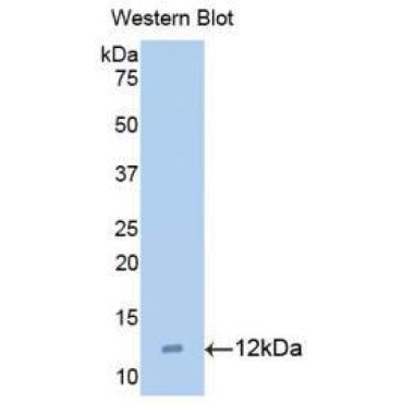 Macrophage Inflammatory Protein 5 (MIP5) Human Polyclonal Antibody
