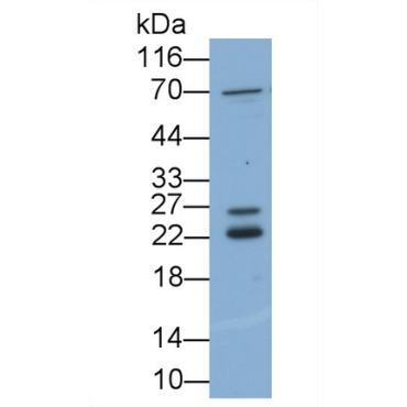 Fibroblast Growth Factor 2, Basic (FGF2) Human Polyclonal Antibody