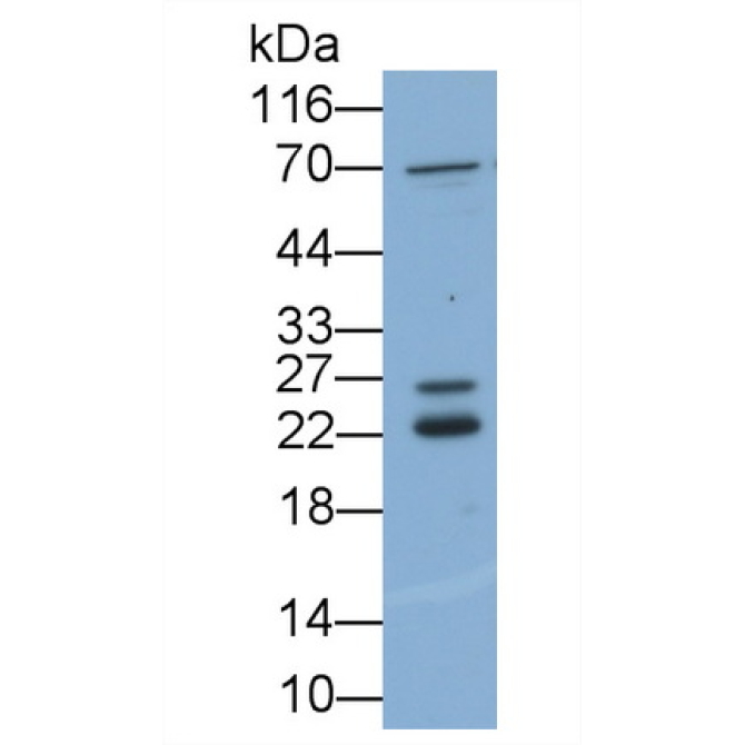 Fibroblast Growth Factor 2, Basic (FGF2) Human Polyclonal Antibody