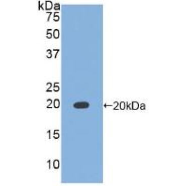 Tissue Inhibitors Of Metalloproteinase 1 (TIMP1) Canis familiaris; Canine (Dog) Polyclonal Antibody