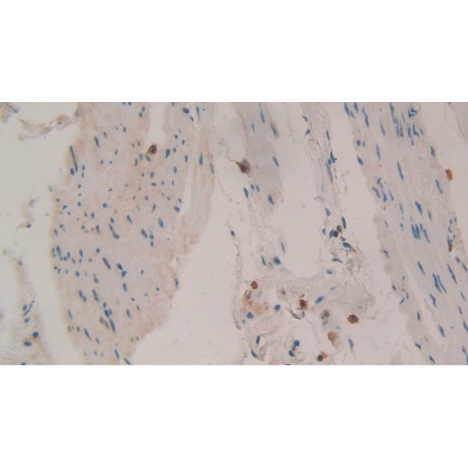 Tissue Inhibitors Of Metalloproteinase 1 (TIMP1) Human Polyclonal Antibody