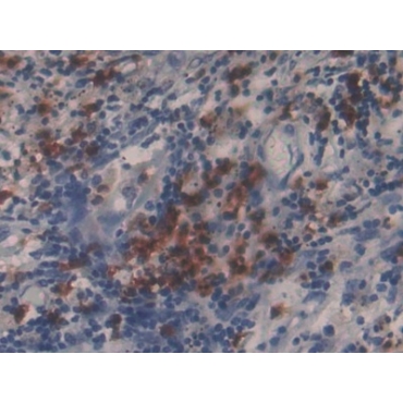 Matrix Metalloproteinase 9 (MMP9) Human Polyclonal Antibody