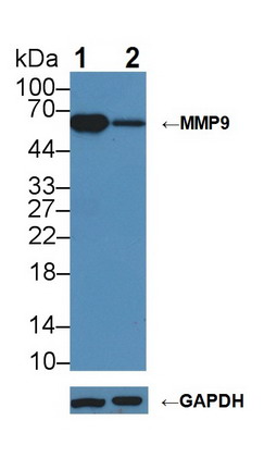 Matrix Metalloproteinase 9 (MMP9) Mouse Polyclonal Antibody