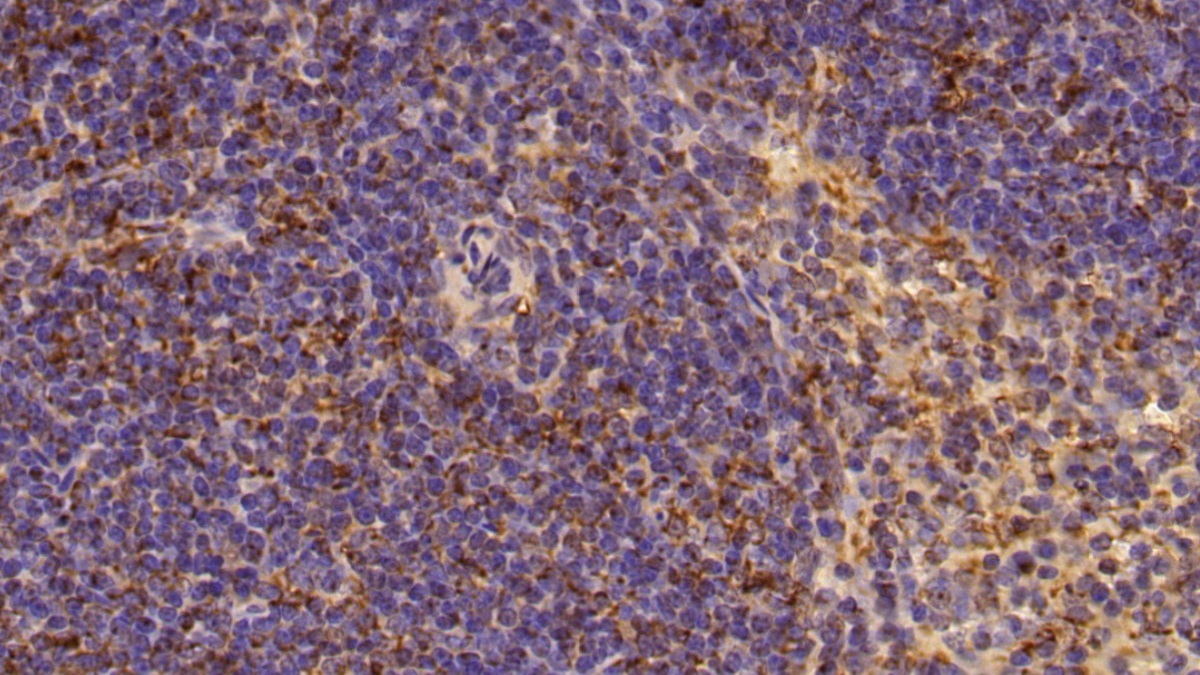 Matrix Metalloproteinase 9 (MMP9) Mouse Polyclonal Antibody
