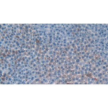 Matrix Metalloproteinase 9 (MMP9) Mouse Polyclonal Antibody
