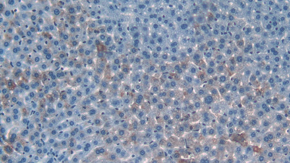 Matrix Metalloproteinase 9 (MMP9) Mouse Polyclonal Antibody