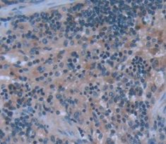 Matrix Metalloproteinase 9 (MMP9) Rat Polyclonal Antibody