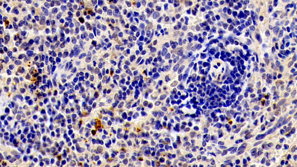 Matrix Metalloproteinase 9 (MMP9) Rabbit Polyclonal Antibody