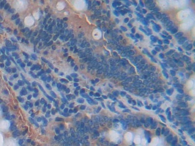 Nicotinamide Adenine Dinucleotide Phosphate Oxidase 1 (NOX1) Rat Polyclonal Antibody