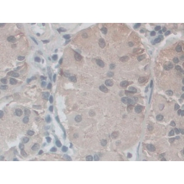 Nicotinamide Adenine Dinucleotide Phosphate Oxidase 5 (NOX5) Human Polyclonal Antibody
