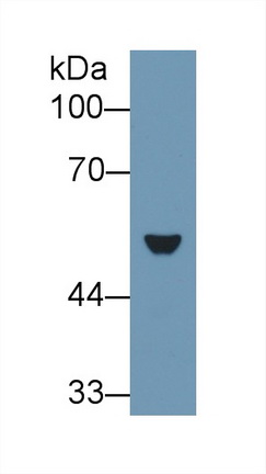 Cytokeratin 7 (CK7) Rat Polyclonal Antibody