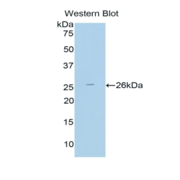 Thyroid Peroxidase (TPO) Human Polyclonal Antibody