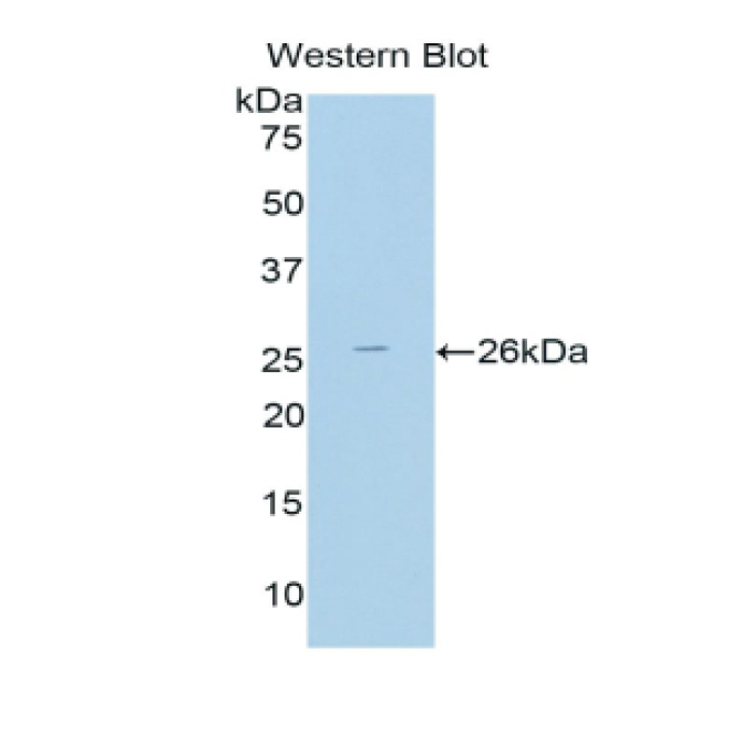 Thyroid Peroxidase (TPO) Human Polyclonal Antibody