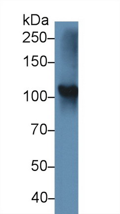 Thyroid Peroxidase (TPO) Mouse Polyclonal Antibody
