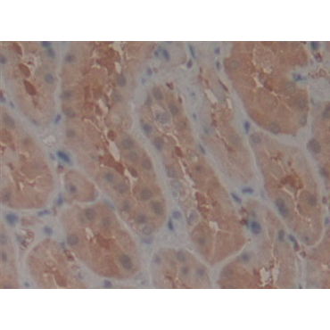 Telomerase protein component 1 (TEP1) Human Polyclonal Antibody
