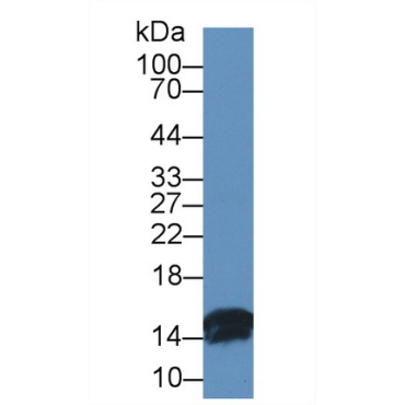 Fatty Acid Binding Protein 2, Intestinal (FABP2) Bovine (Cattle) Polyclonal Antibody