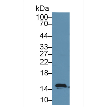Fatty Acid Binding Protein 2, Intestinal (FABP2) Human Polyclonal Antibody
