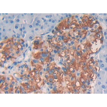 Epidermal Growth Factor (EGF) Human Polyclonal Antibody