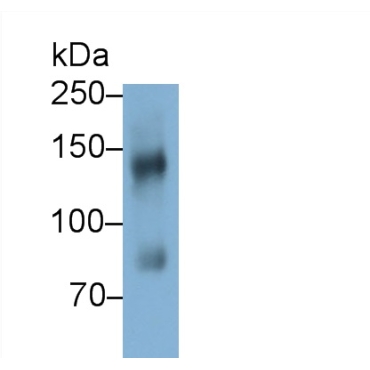 Epidermal Growth Factor (EGF) Mouse Polyclonal Antibody
