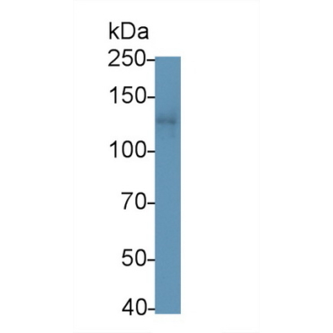 Leukemia Inhibitory Factor Receptor (LIFR) Human Polyclonal Antibody