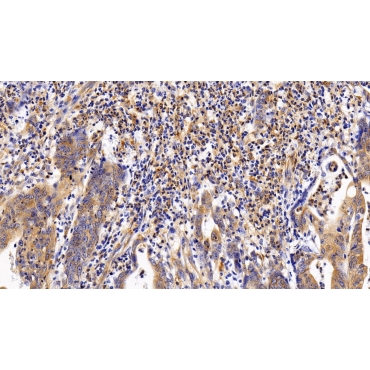 Leukemia Inhibitory Factor Receptor (LIFR) Human Polyclonal Antibody