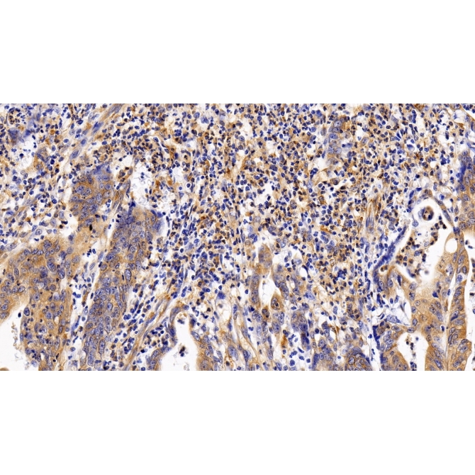 Leukemia Inhibitory Factor Receptor (LIFR) Human Polyclonal Antibody