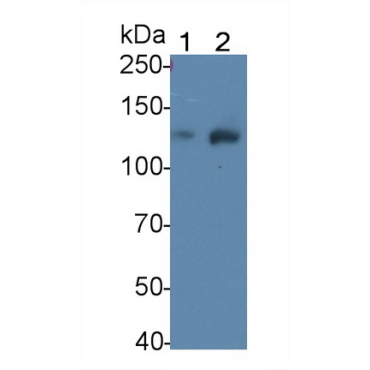 Leukemia Inhibitory Factor Receptor (LIFR) Human Polyclonal Antibody